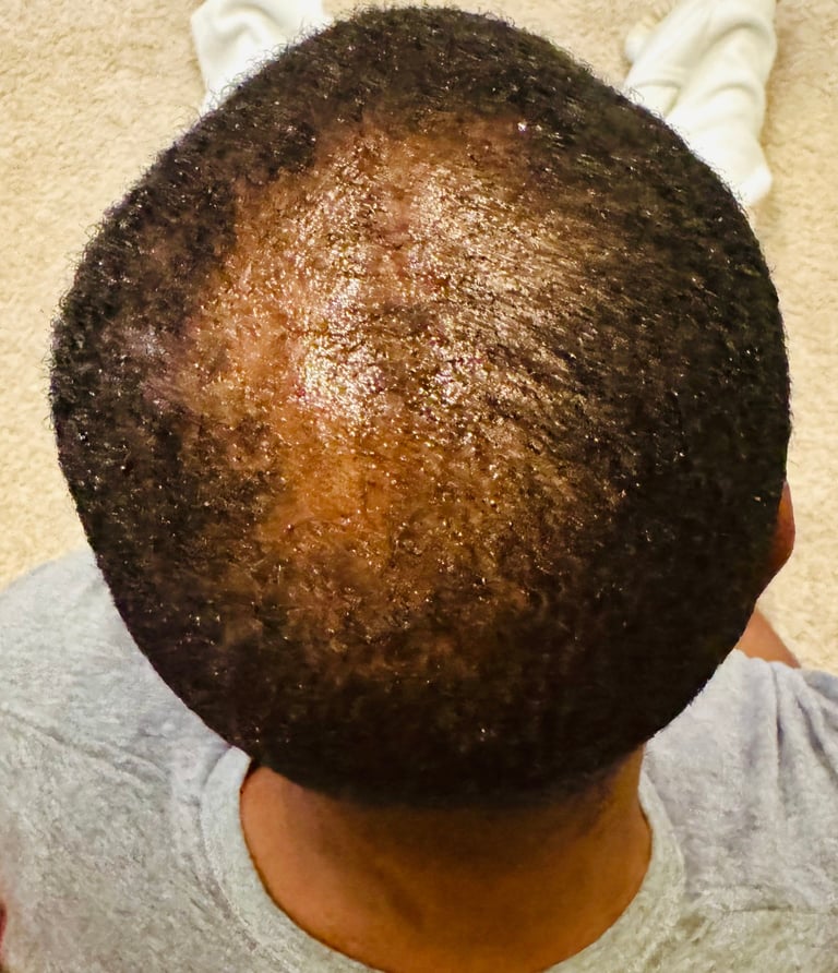 Back of persons head showing short curly hair with glitter or sparkly substance applied
