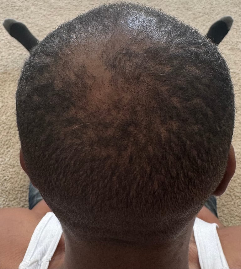 Back view of a persons head showing short dark hair and small black horn-like protrusions or accessories on top